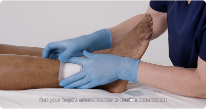 Application of Biatain Fiber Ag