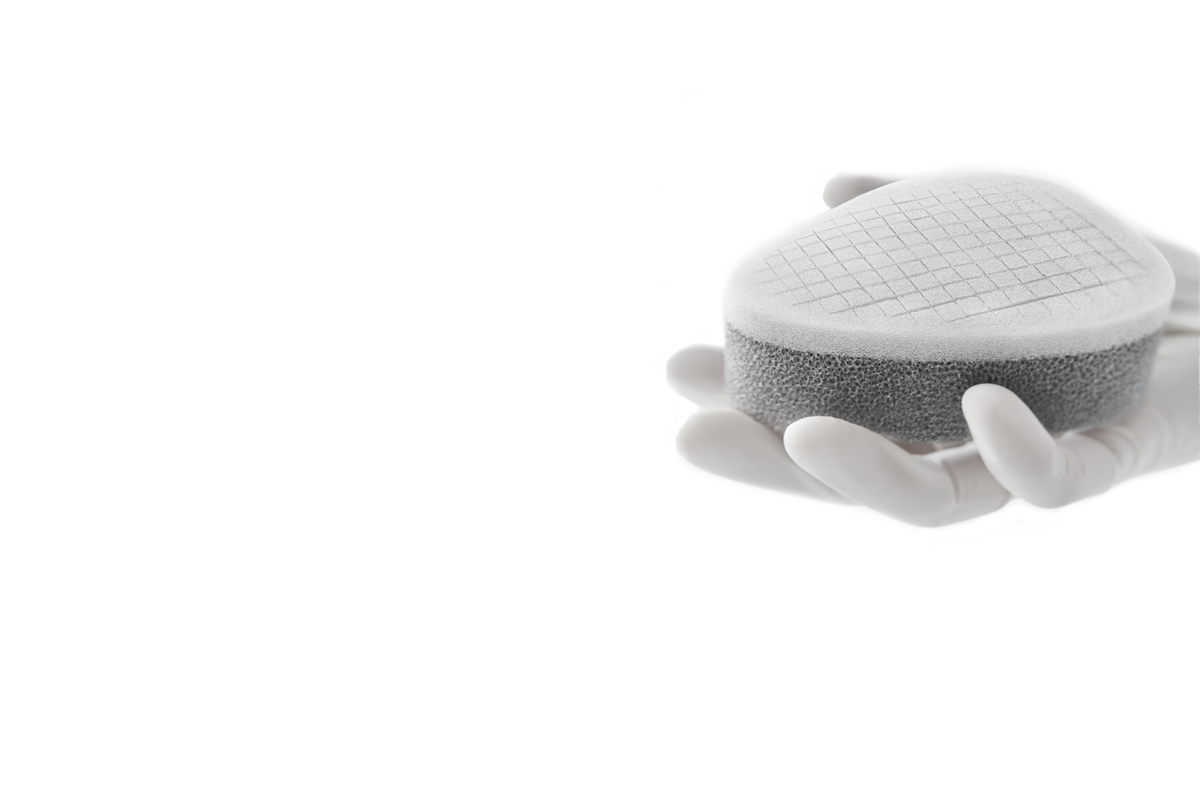 The role of Alprep Pad® in facilitating shared care of diabetic foot ulceration