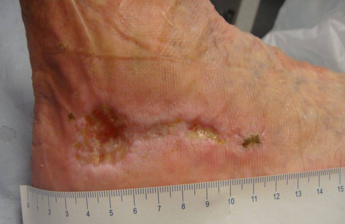 Holistic wound assessment