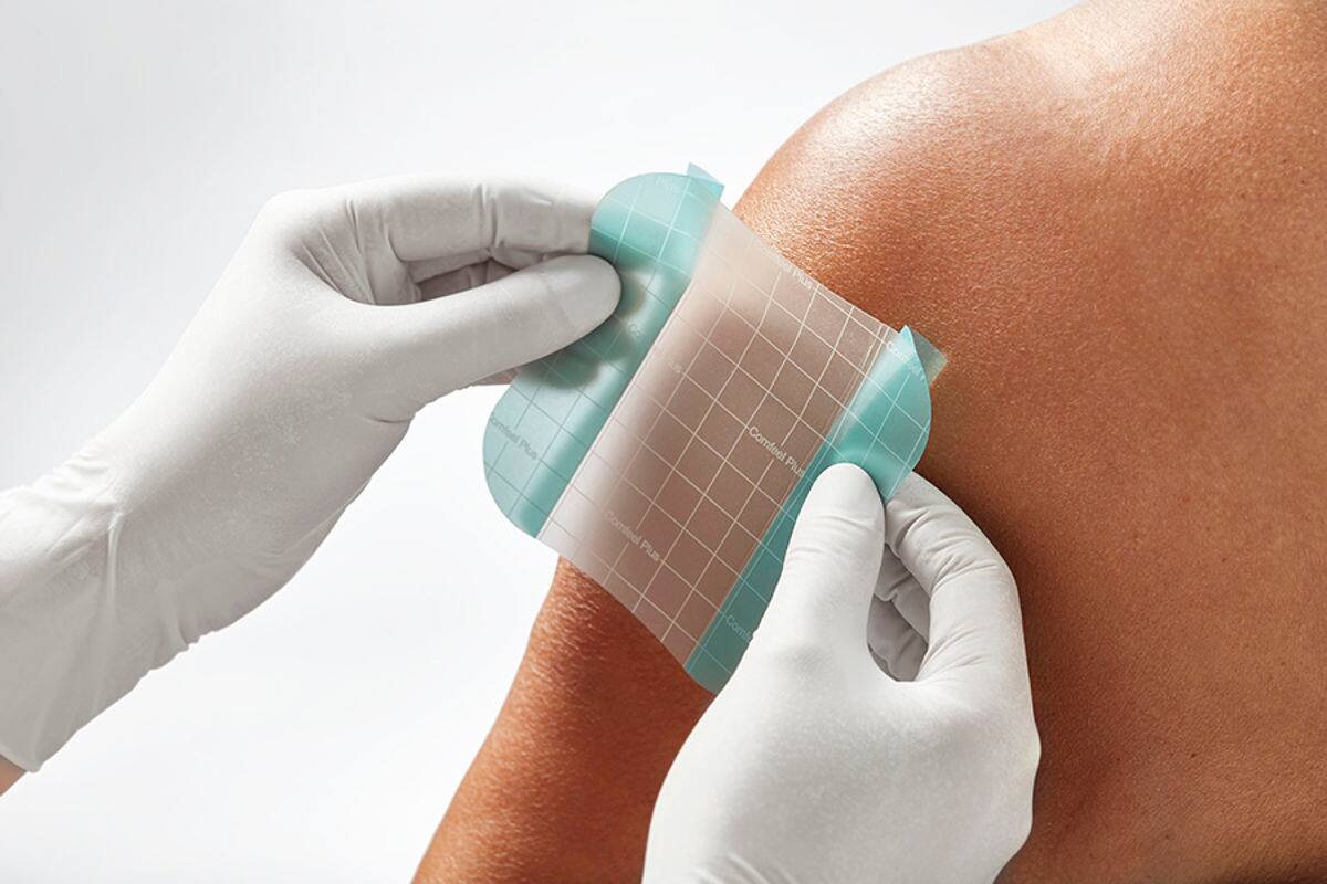 How do I select the right hydrocolloid dressing?