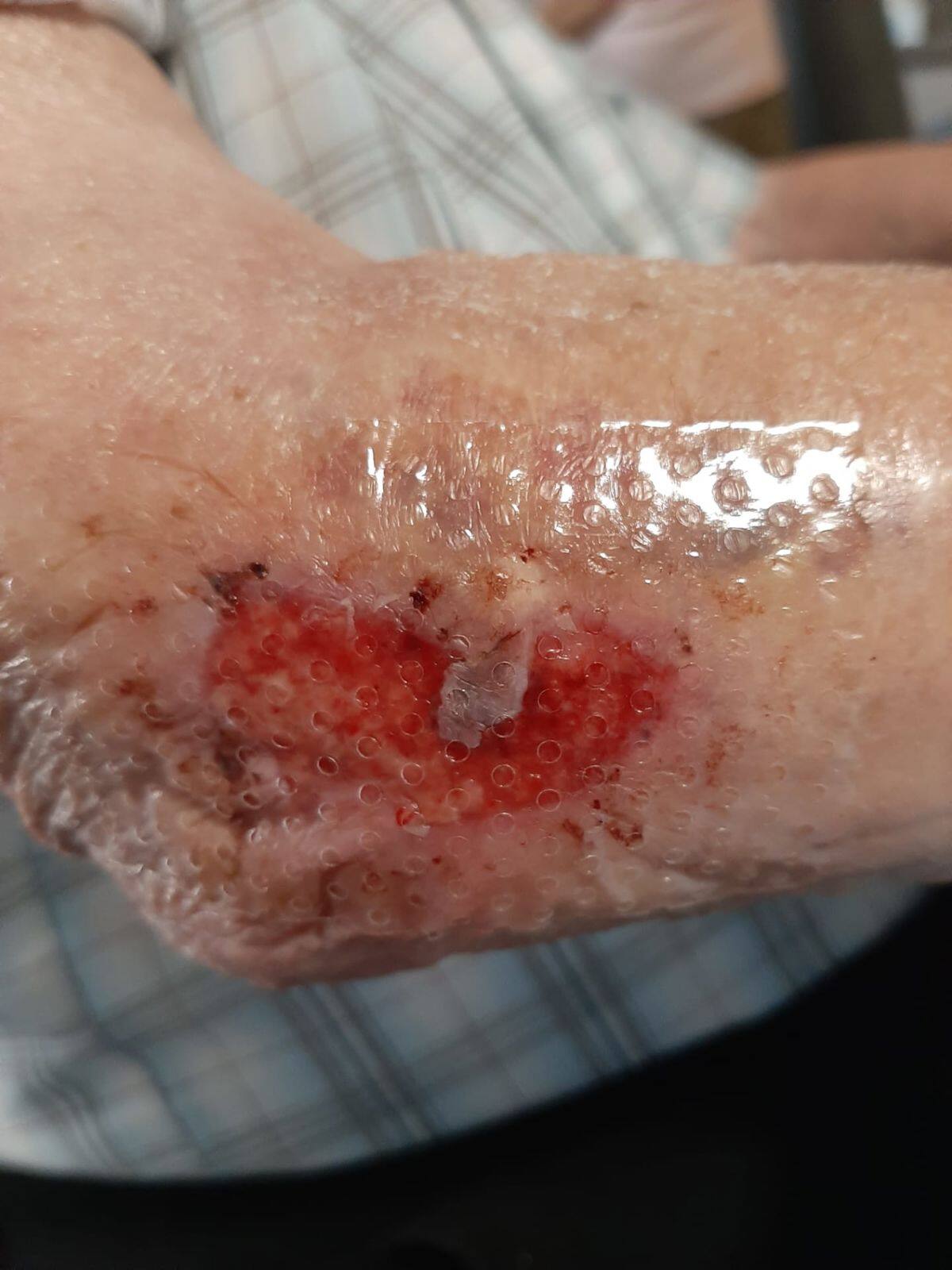 When should you use a contact layer?