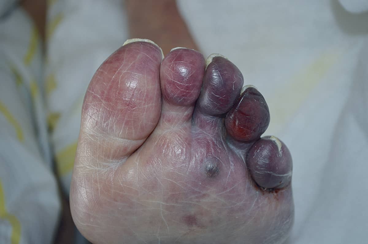 What is the circulatory system?