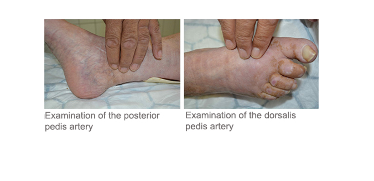 When you examine the leg, check for: